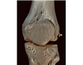 verrassend bijeffect suppletie glucosamine en chondro tine