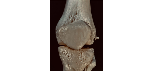 chondro tine en glucosamine effectief bij artrose